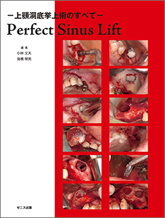 Perfect Sinus Lift－上顎洞底挙上術のすべて－｜ゼニス出版