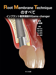 Root Membrane Technique のすべて